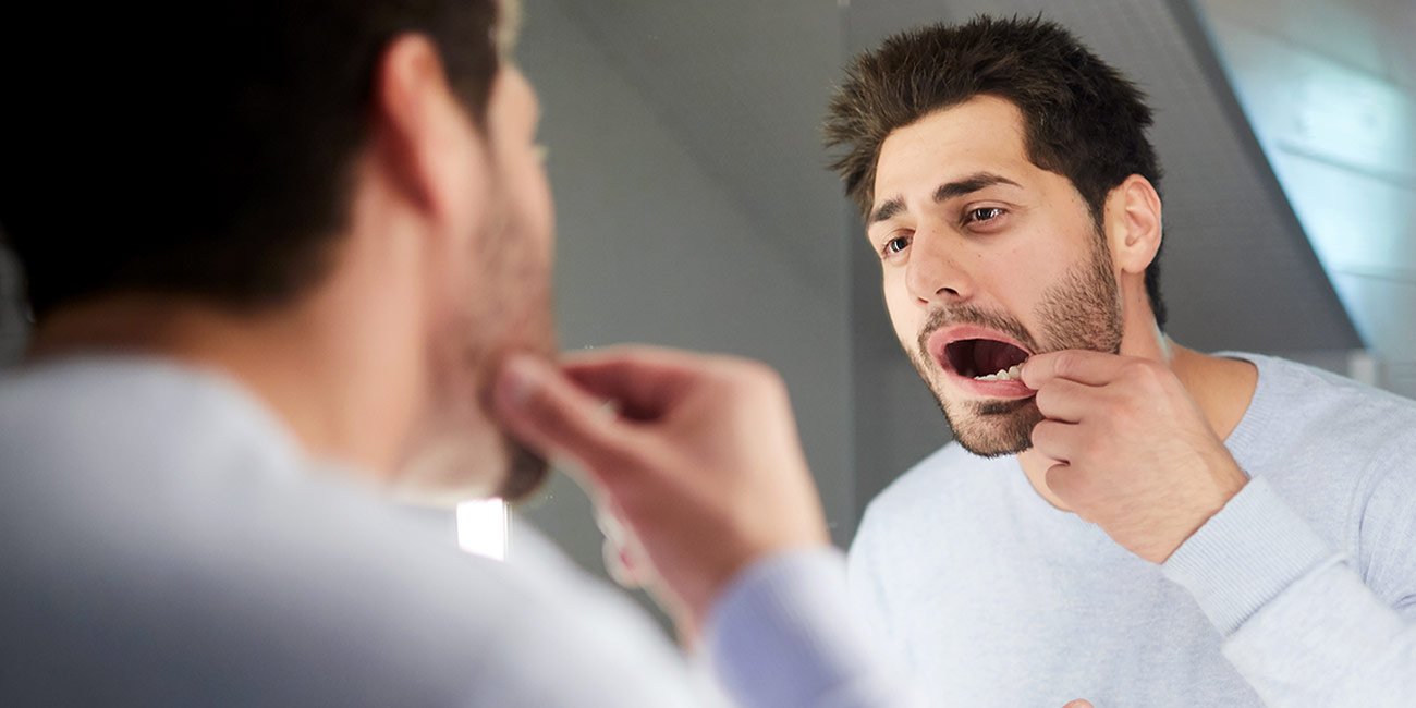 liquen plano síntomas y causas