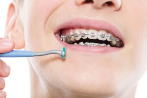 Cepillos interdentales: Conoce todos sus beneficios