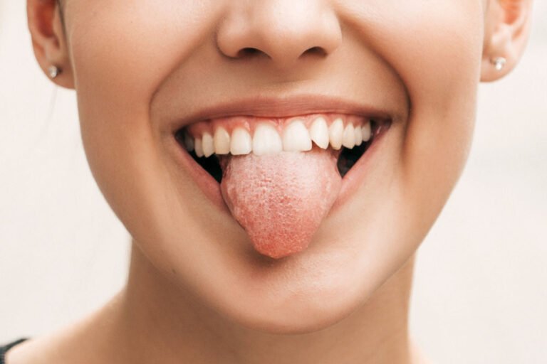 Leucoplasia: aprende todo lo necesario Leucoplasia: aprende todo lo necesario