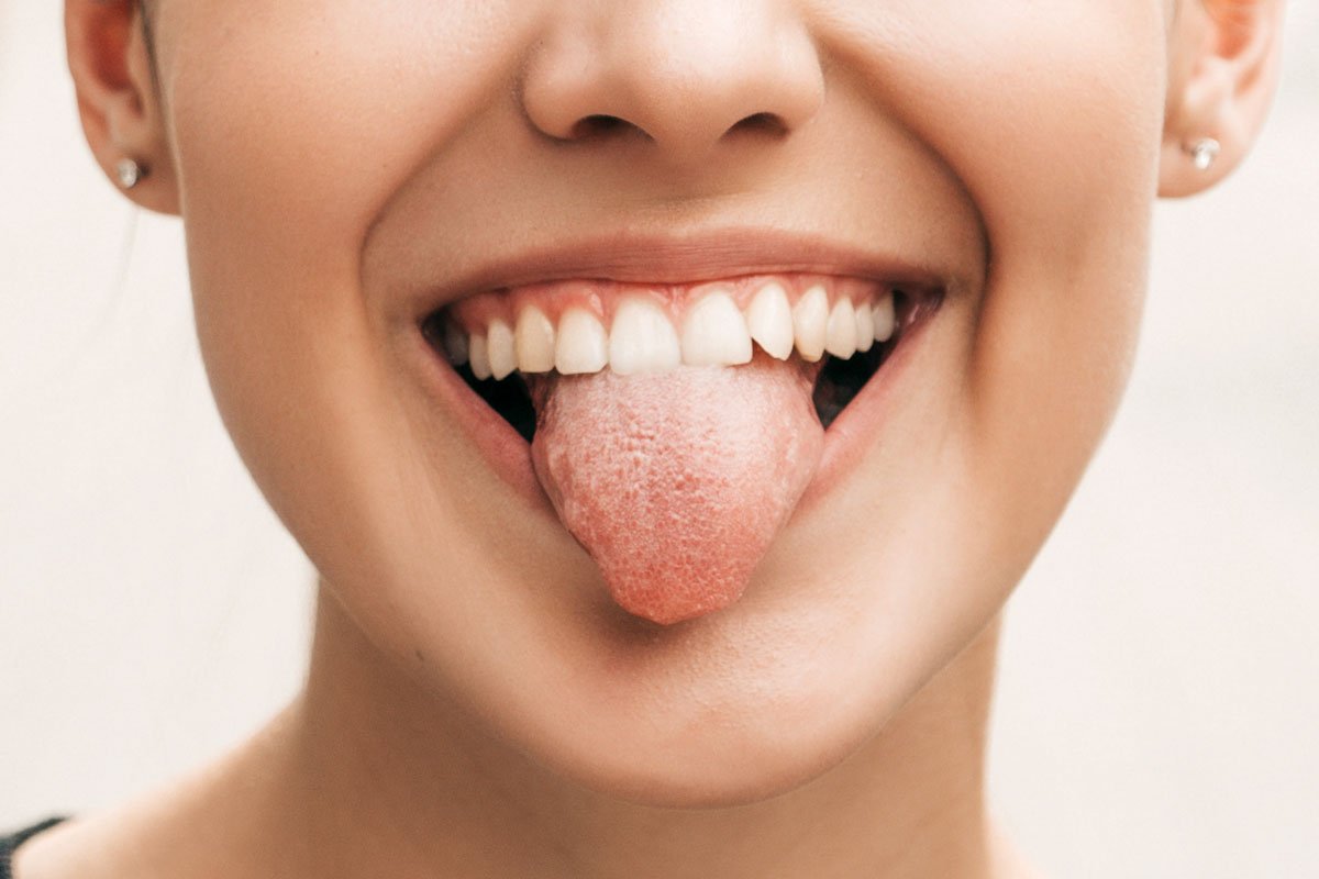 Leucoplasia: aprende todo lo necesario Leucoplasia: aprende todo lo necesario