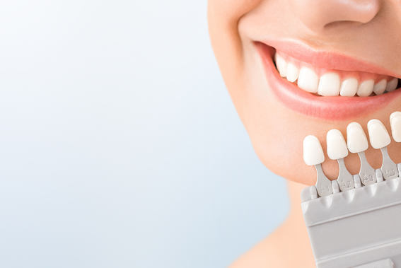 Consejos para que el blanqueamiento dental te dure el máximo tiempo posible