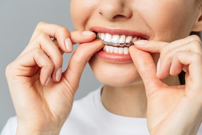 Consejos durante el tratamiento de Invisalign
